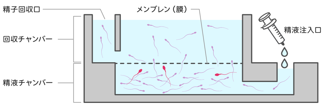 ザイモートスパームセパレーター